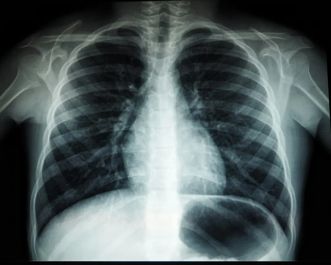 Radiografia risipei: Planul lui Dumitru Chisăliță pentru a scoate energia României din impas